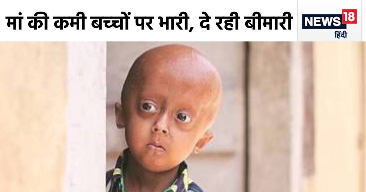 प्रेग्नेंसी में एक गलती से बच्चों के ब्रेन में आ रही खतरनाक दिक्कत, करवाना पड़ सकता है अबॉर्शन, डॉ. ने दी सलाह प्रेग्नेंसी में एक गलती से बच्चों के ब्रेन में आ रही खतरनाक दिक्कत, करवाना पड़ सकता है अबॉर्शन, डॉ. ने दी सलाह