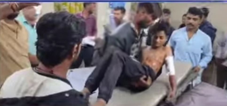 Damoh: खेत जा रहे नाबालिग को रास्ते में मिला कट्टा, फायर करते ही शरीर में धंसे छर्रे, करना पड़ा जबलपुर रेफर