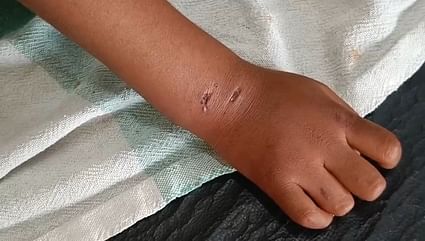 Ujjain News: घर में सोया था चार साल का मासूम, कुत्ता आया और मुंह से दबाकर ले गया, बचाने गए पिता भी लहूलुहान